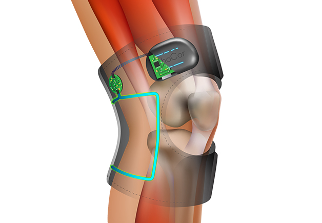 Illustration of the antenna loop on the OrthoCor Knee device highlighting the source of PEMF therapy.